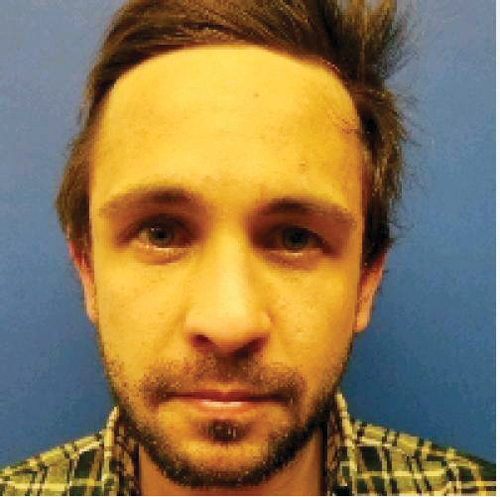 Local man faces drug charges